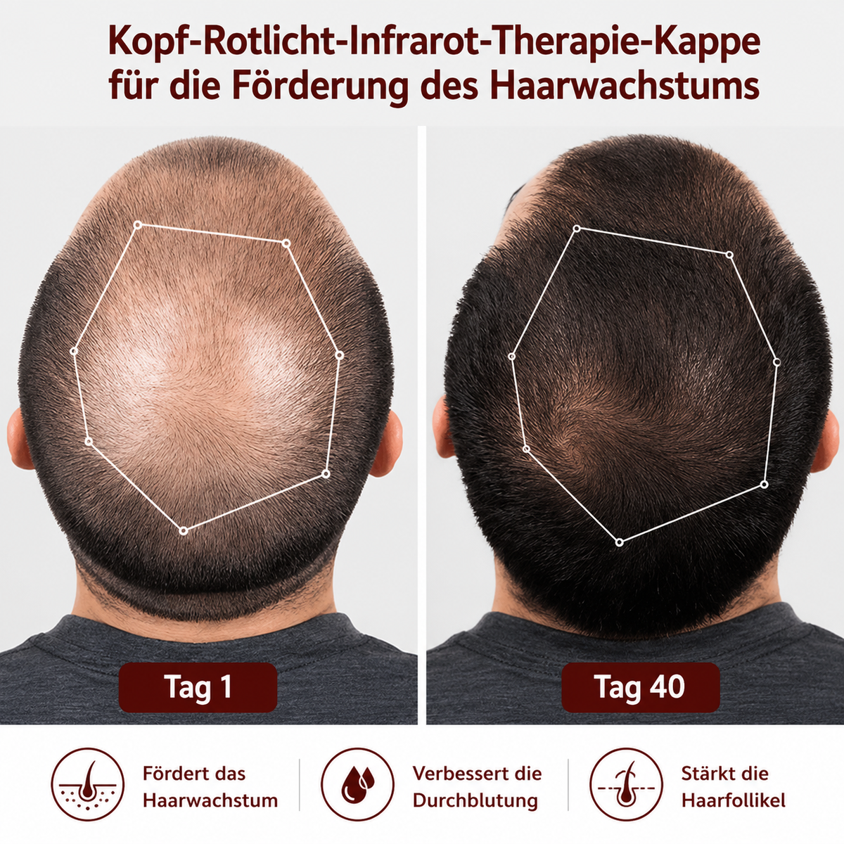 Rotlicht-Therapiekappe für gesunde Haarbehandlung
