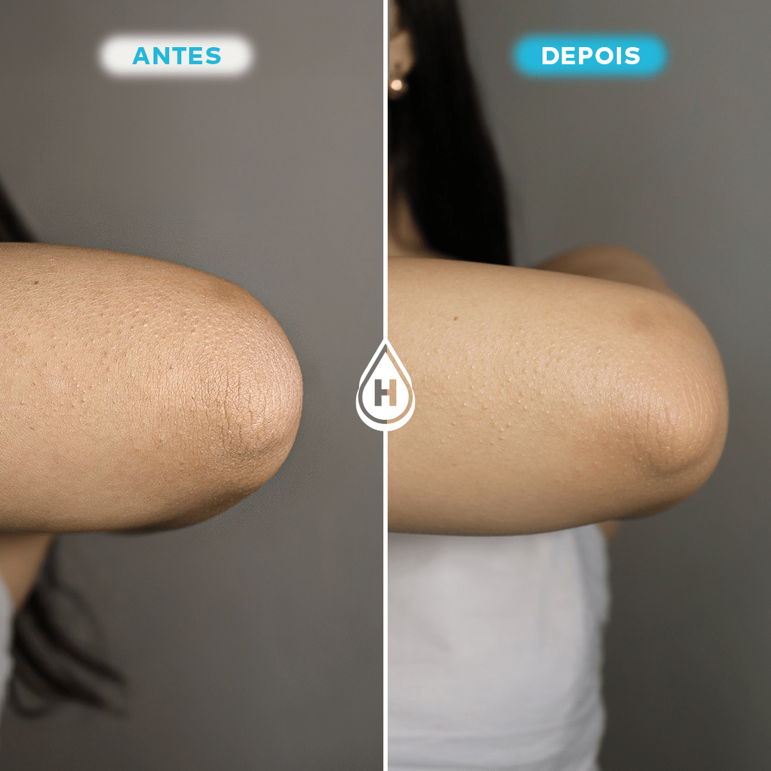 Loção Hidratante Corporal 200ml Oferta Especial