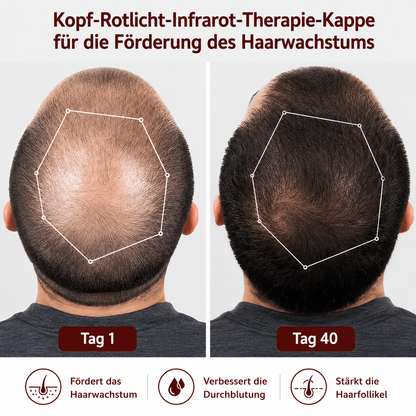 Rotlicht-Therapiekappe für gesunde Haarbehandlung